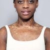 Michaela Deprince as Self