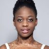Michaela Deprince as Herself (as Michaela DePrince)