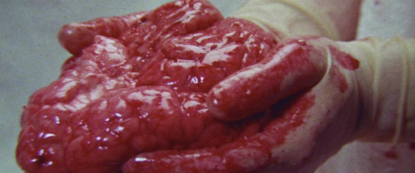 Brain of Blood background