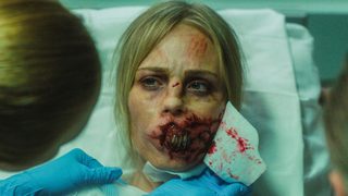 Rabid still 2
