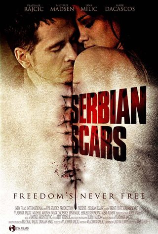 Serbian Scars still 3