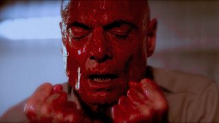 The Human Centipede 3 (Final Sequence) still 3