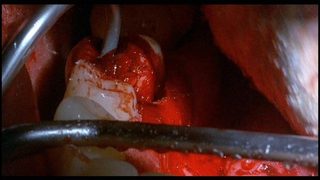 The Dentist 2 still 7