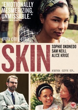Skin still 2
