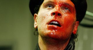 Scar still 5