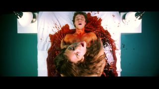 Excision still 2